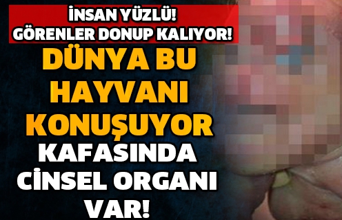 Cinsel organı alnında doğdu; Bilim dünyası şaşkın 1
