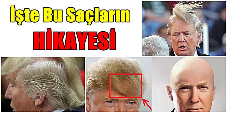 TRUMP "KEL Mİ" ; UZMANI AÇIKLADI