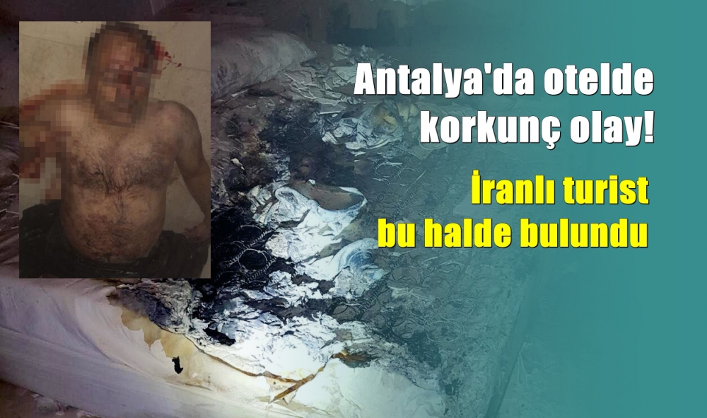 Antalya’da otelde kavga çıktı, odayı ateşe verdi 1