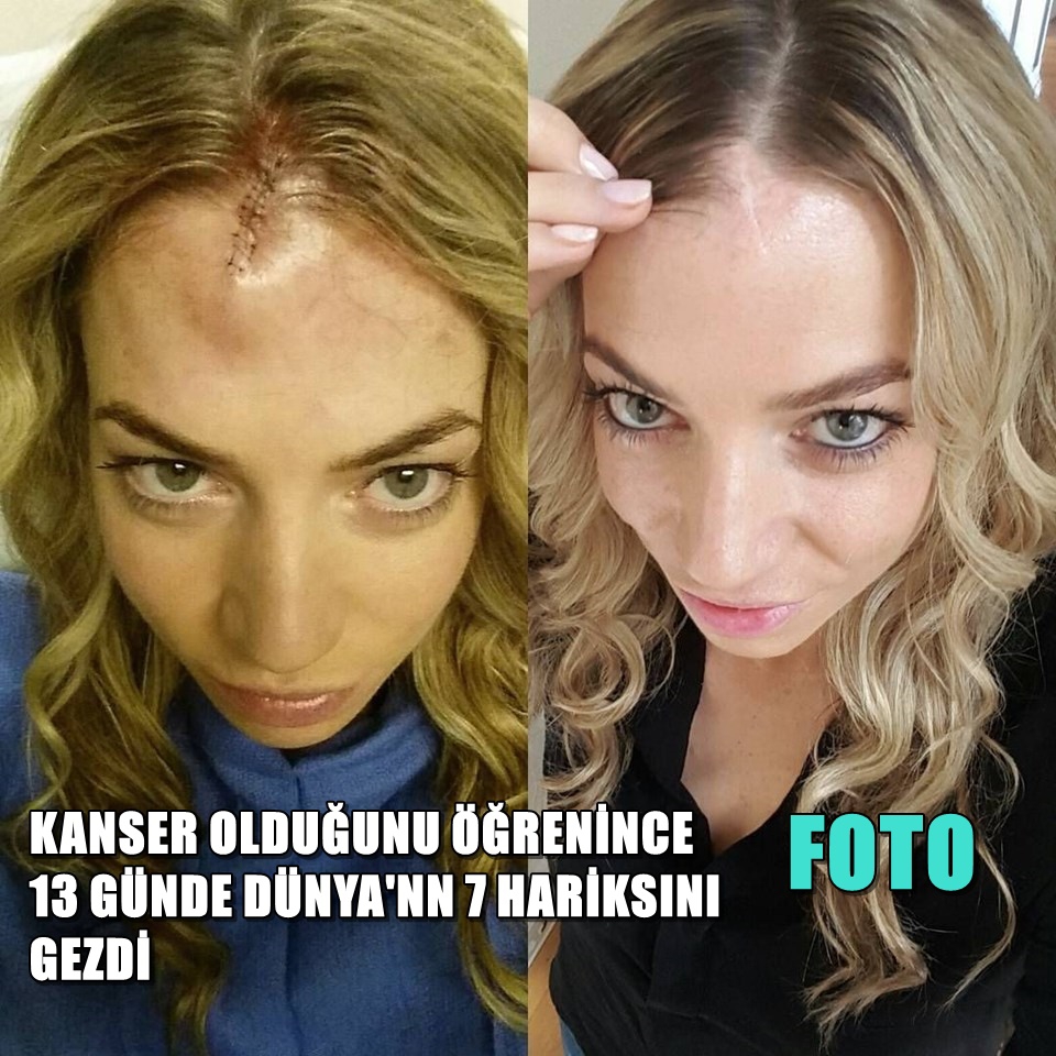 KANSER OLUNCA DÜNYA'NIN 7 HARİKASINI GEZDİ 1
