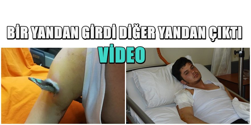 ÜRPERTEN GÖRÜNTÜ Samsun'da Korkuluk Faciası