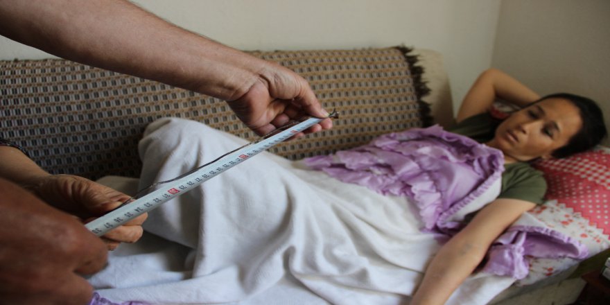 Böbreğinde Unutulan Katater Teli 10 Yıl Sonra Fark Edildi