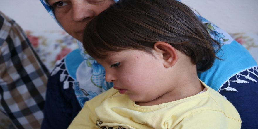 Minik Meryem Günden Güne Eriyor: Yardım Bekliyor