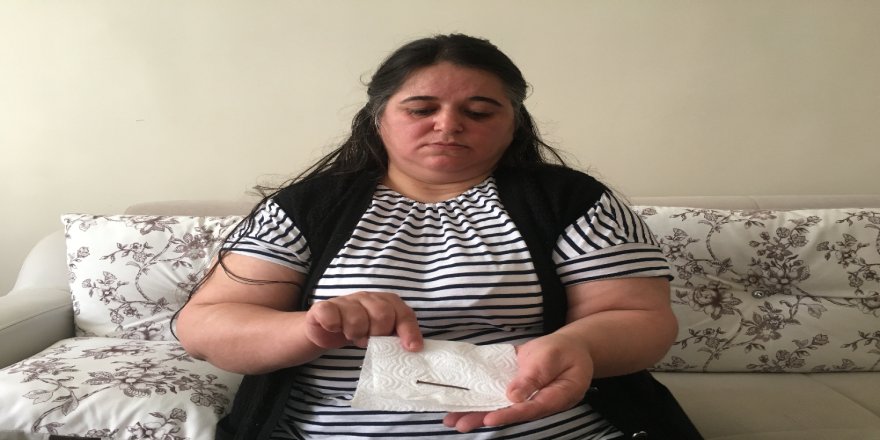 Karnı Şişen Kadının Midesinden Çıkan Şoke Etti