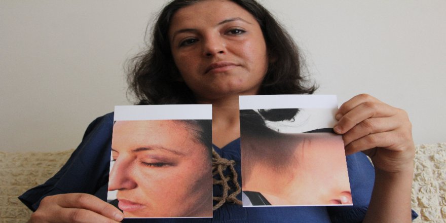 "Emine Bulut Gibi Çocuklarımın Önünde Ölmek İstemiyorum”