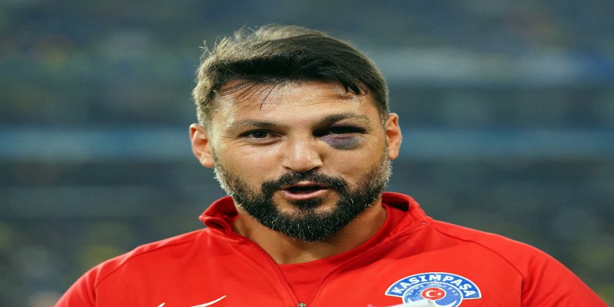 Ramazan Köse’nin Gözündeki Morluk Dikkat Çekti