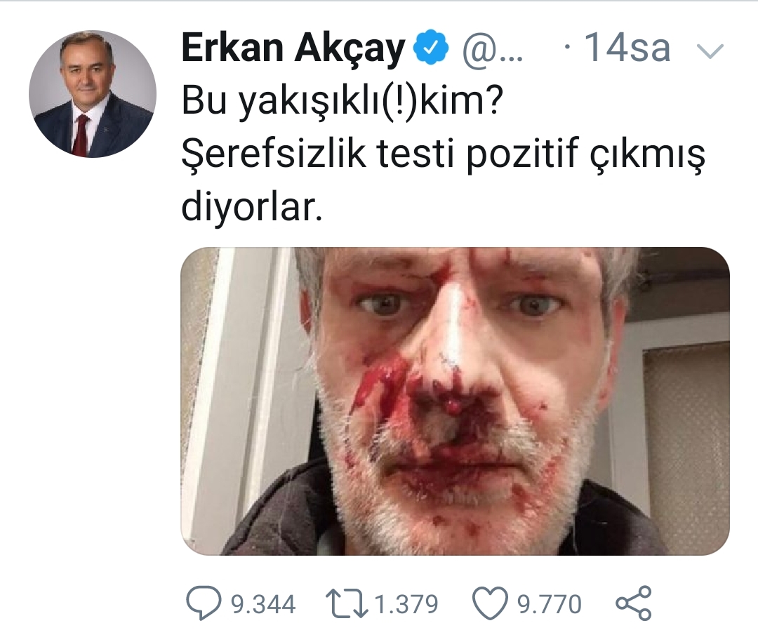 MHP'Lİ ERKAN AKÇAY'IN TWİTTİ OLAY OLDU