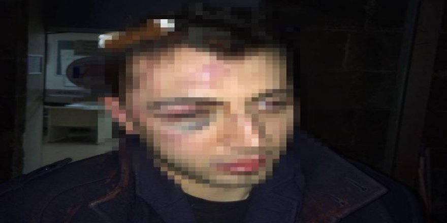 İZMİRDE AVUKATA ÖLDÜRESİYE DAYAK