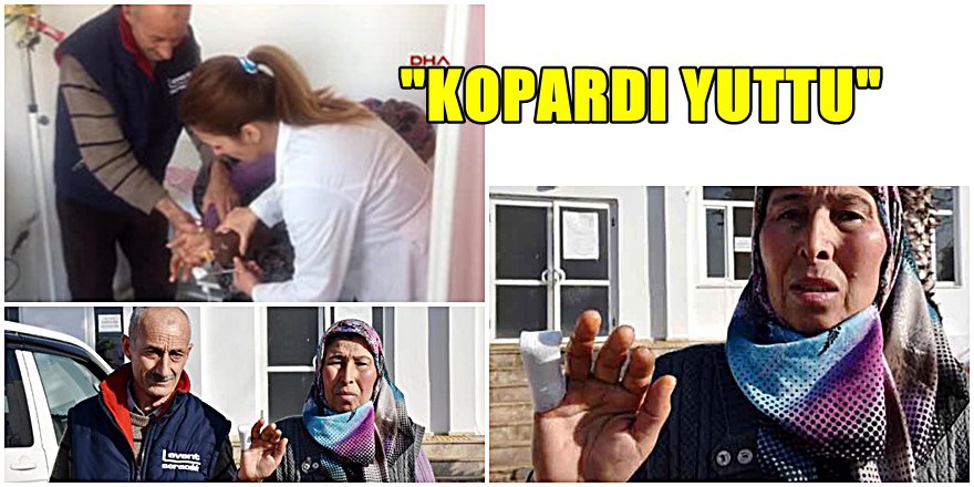 ANTALYA'DA KADIN KAVGASINDA VAHŞET