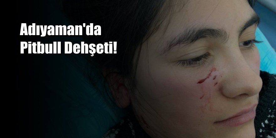 Adıyaman'da Pitbull Dehşeti