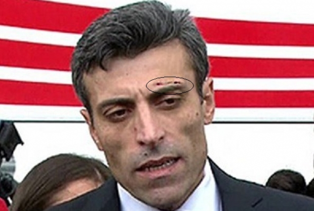 ozturk_yilmaz_musul_konsolosu-yara.jpg