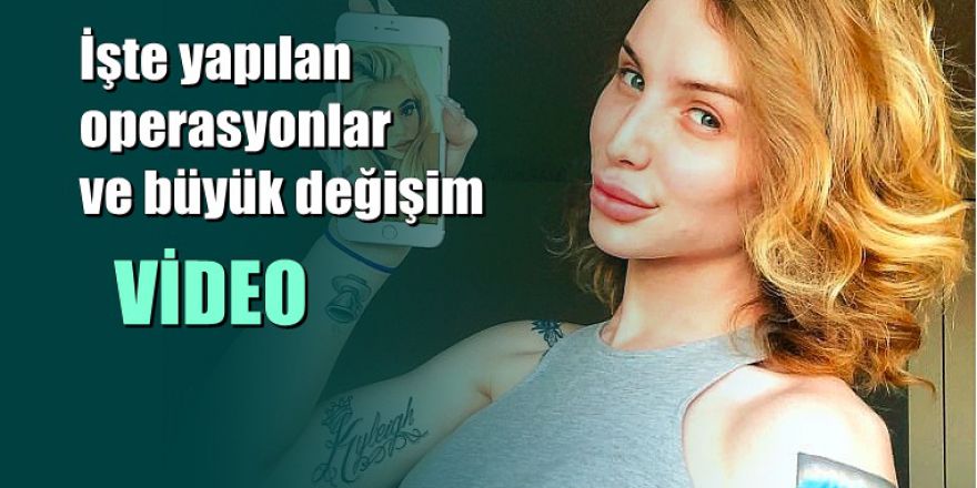 Kylie Jenner'a benzemek için 75.000 dolar harcayan trans genç