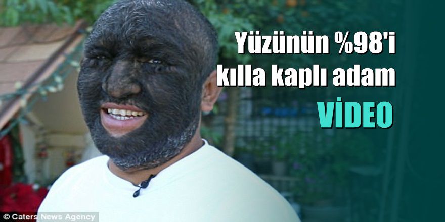 Dünya bu adamı konuşuyor